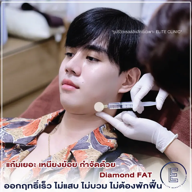 Diamond Fat 