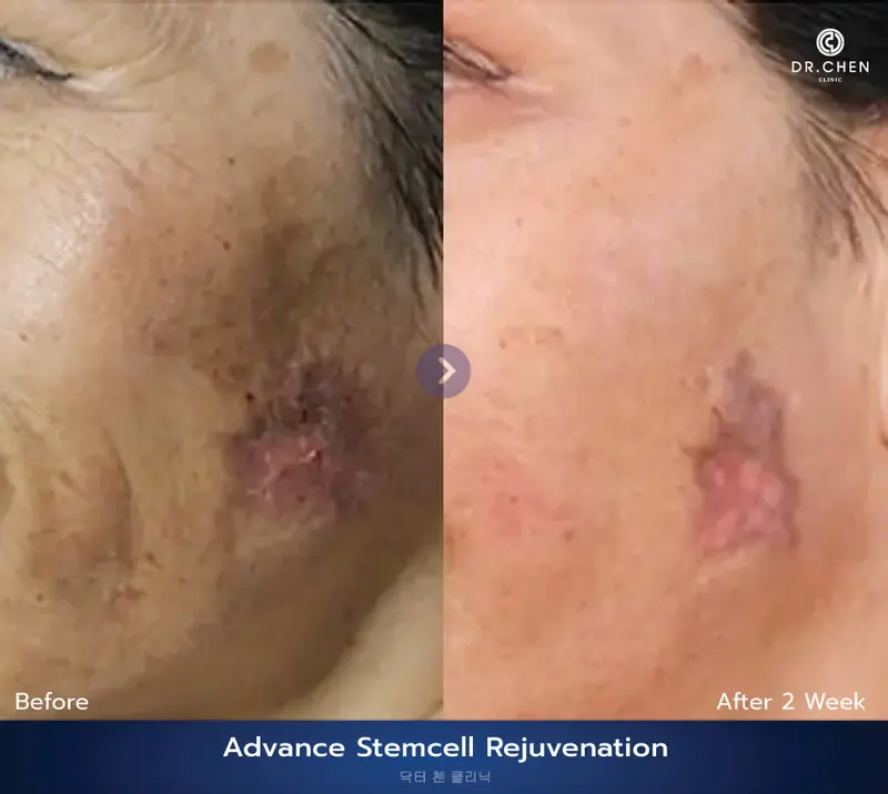 รักษาผิวหน้า