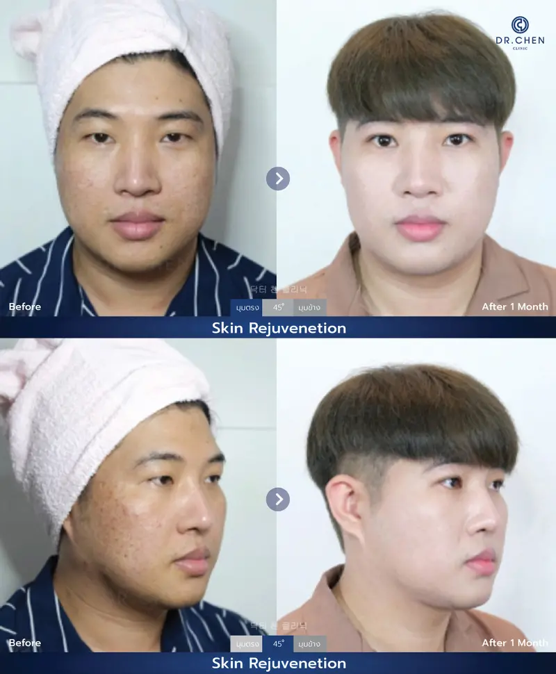 รักษาผิวหน้า