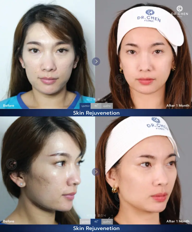 รักษาผิวหน้า