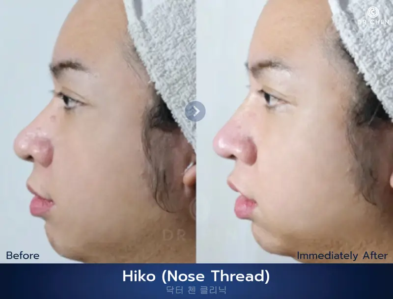 ปรับรูปหน้า