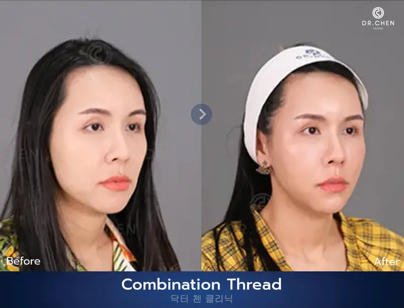 ปรับรูปหน้า