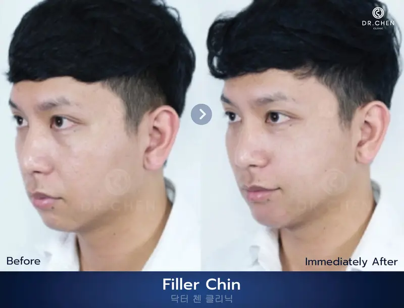 ปรับรูปหน้า