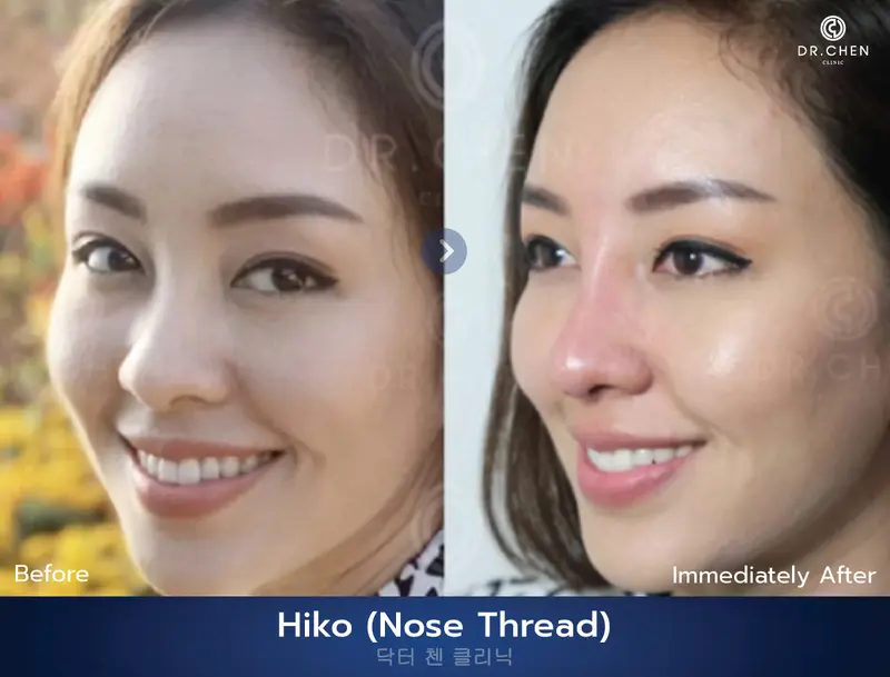 ปรับรูปหน้า