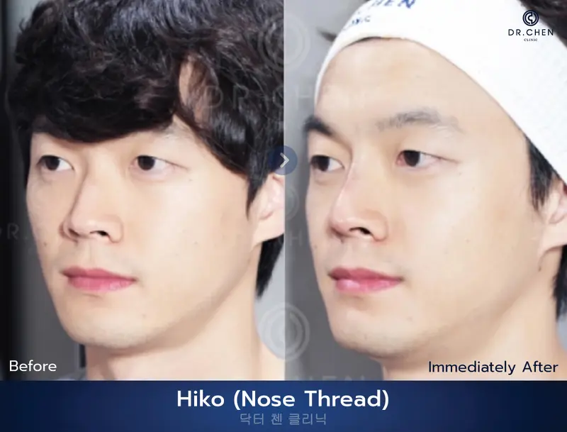 ปรับรูปหน้า