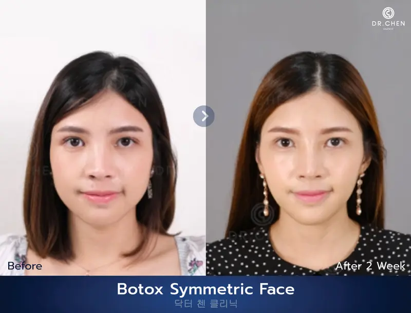 ปรับรูปหน้า