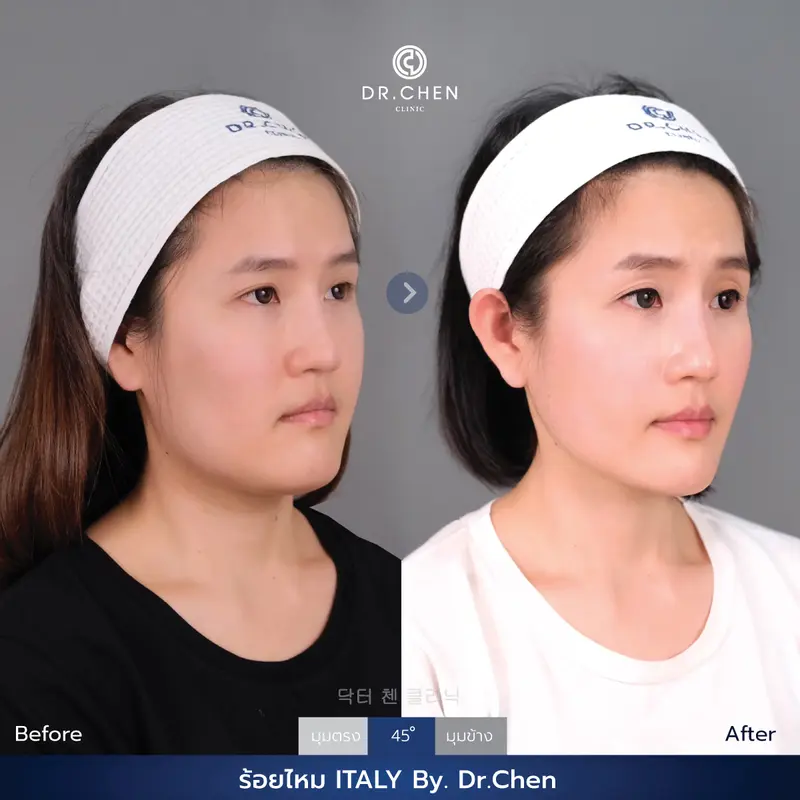 ปรับรูปหน้า