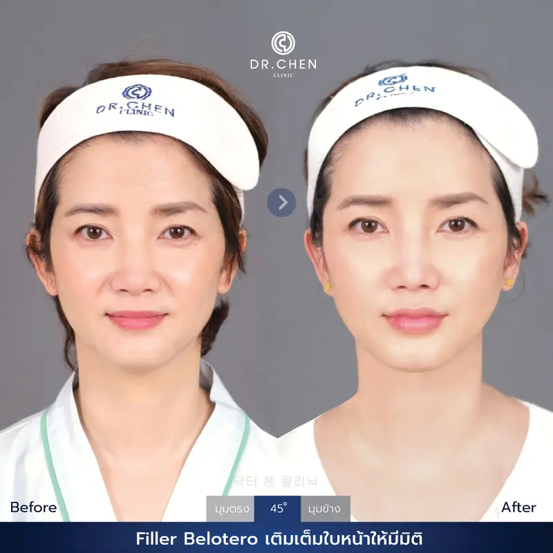 ปรับรูปหน้า