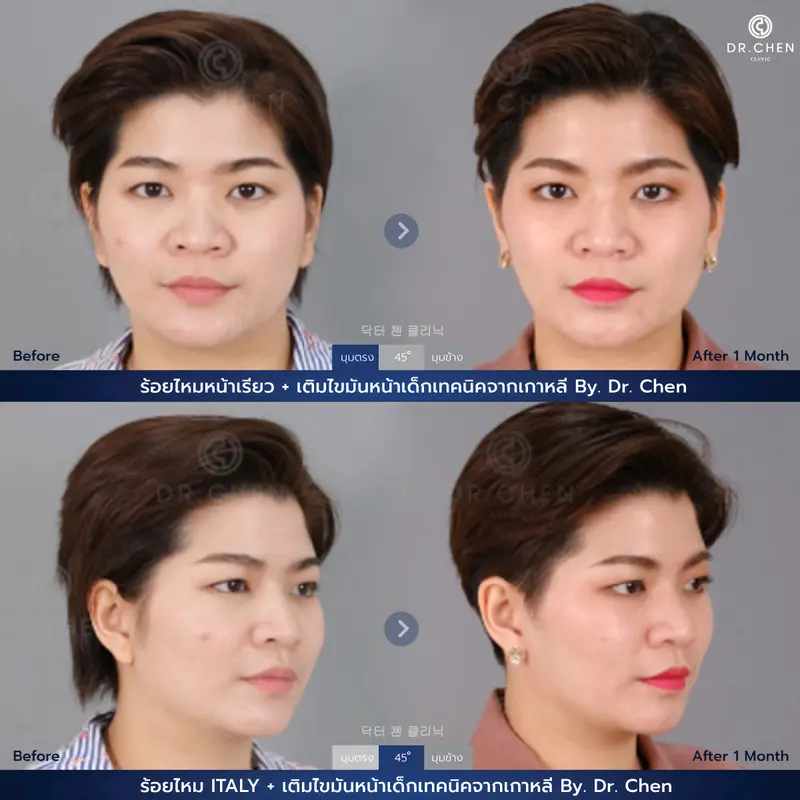 ปรับรูปหน้า