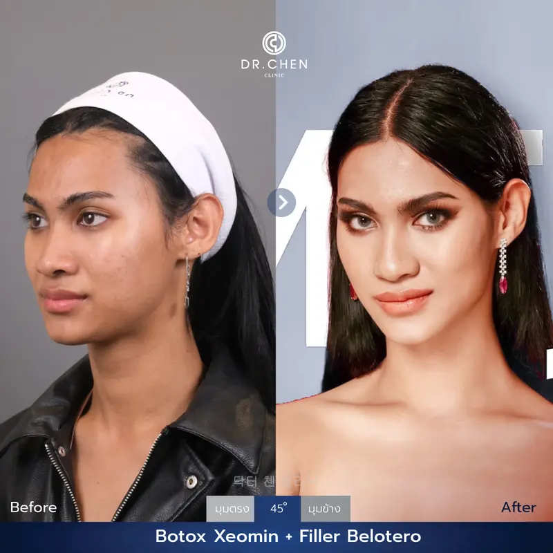 ปรับรูปหน้า