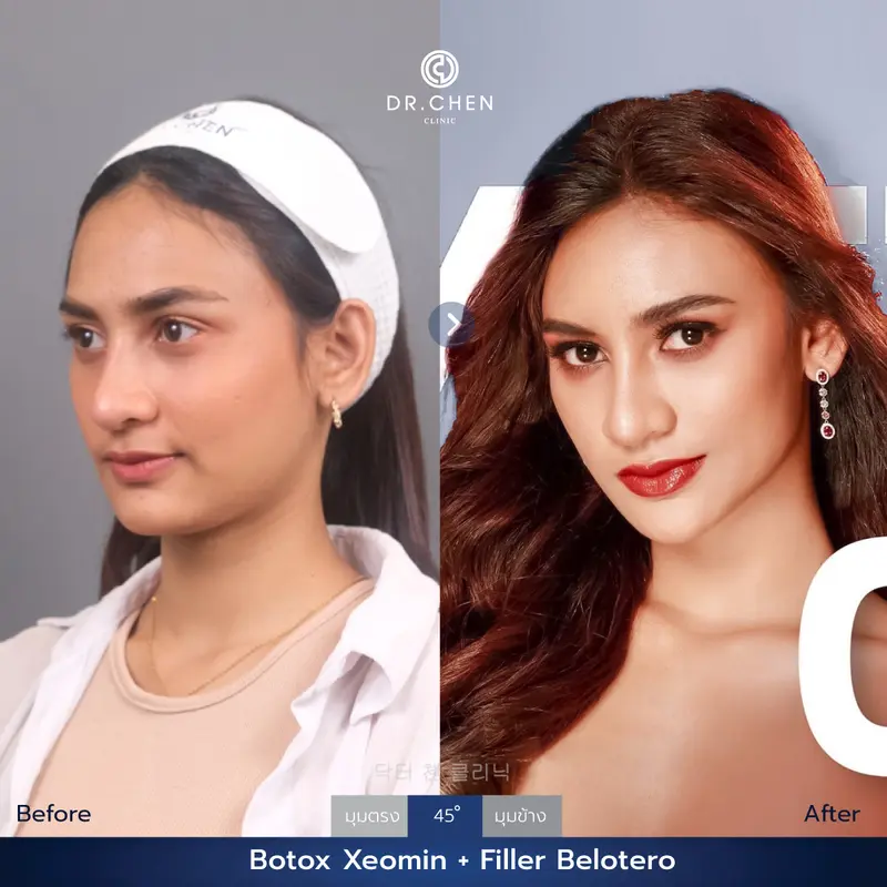 ปรับรูปหน้า