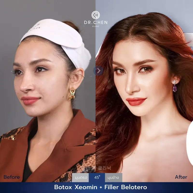 ปรับรูปหน้า