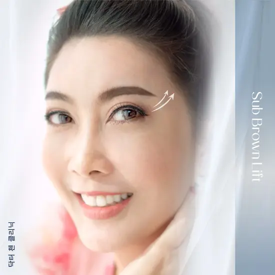 ศัลยกรรมตา