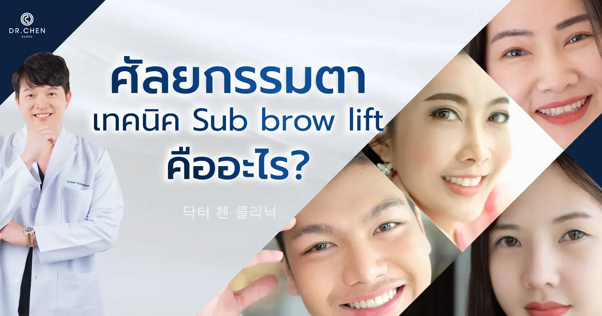 ทำความรู้จักกับ Sub Brow Lift ศัลยกรรมตา เทคนิคเกาหลี 
