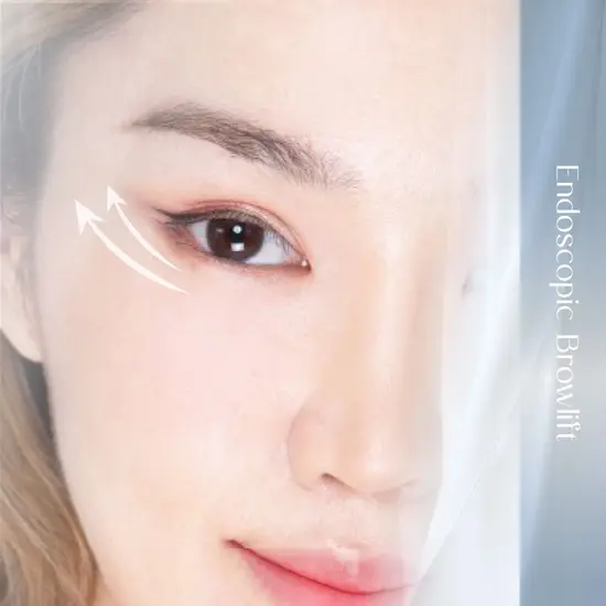 EBL ส่องกล้องยกคิ้ว 