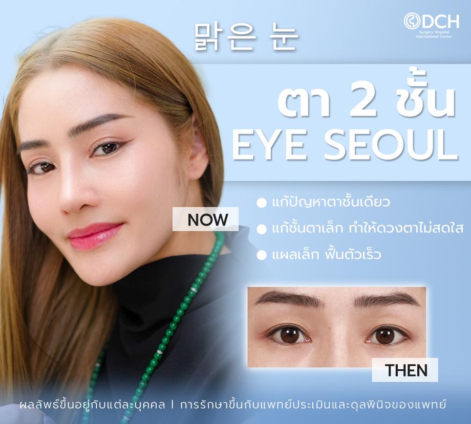 ตาสองชั้นเชียงใหม่