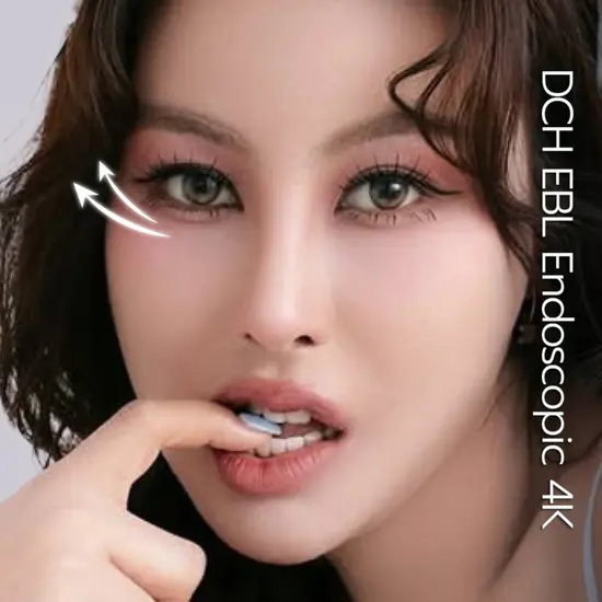 EBL ส่องกล้องยกคิ้ว 