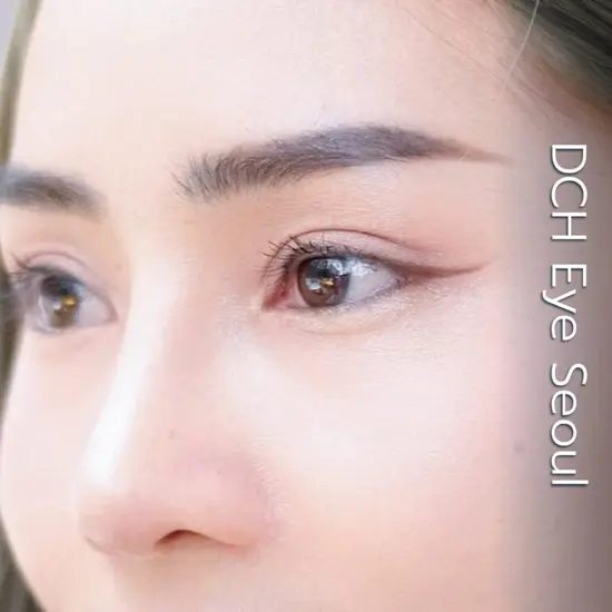 ศัลยกรรมตา