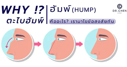ฮัมพ์คืออะไร ทำไมต้องตะไบฮัมพ์ ?