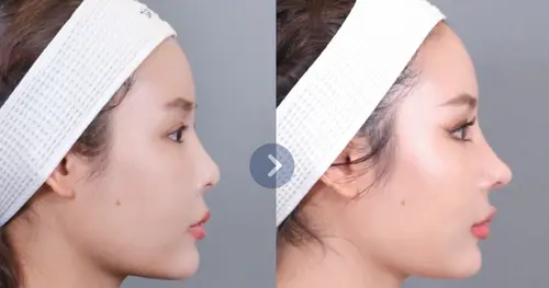 มองแว๊บแรก นึกว่าดาราสาว แก้แล้วสวยเลย 