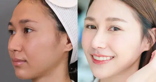 เคสยากแค่ไหน เราแก้ได้ ✨