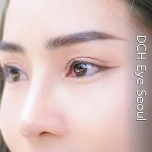 ศัลยกรรมตา