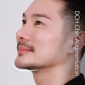 เสริมคาง 