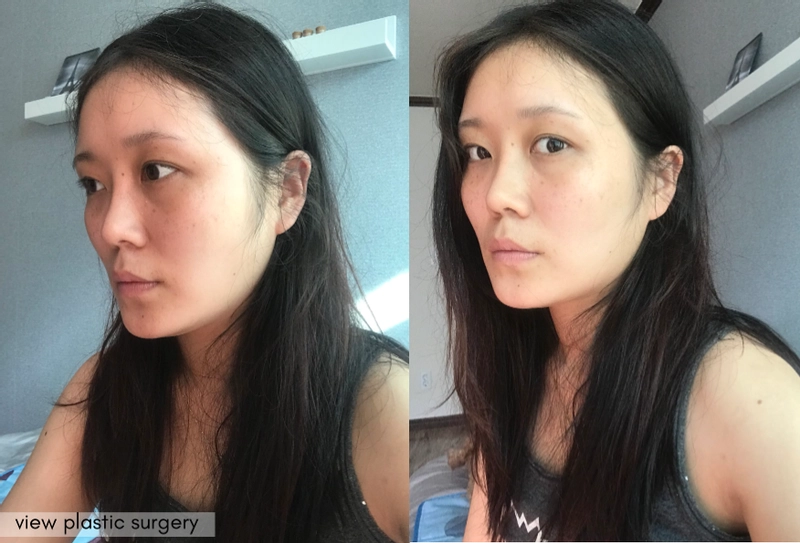 รูปภาพตัวอย่าง