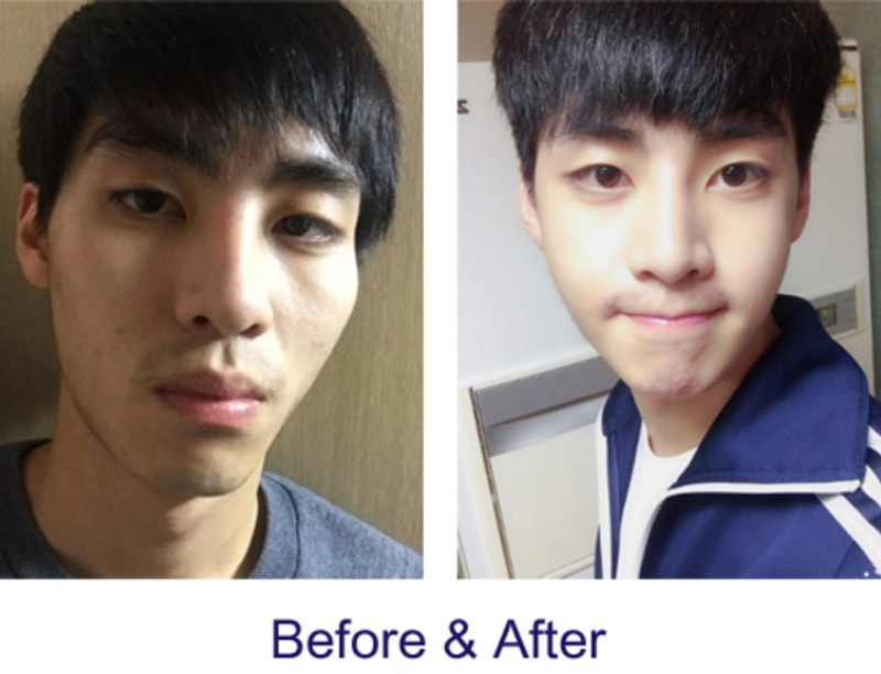 รูปภาพตัวอย่าง