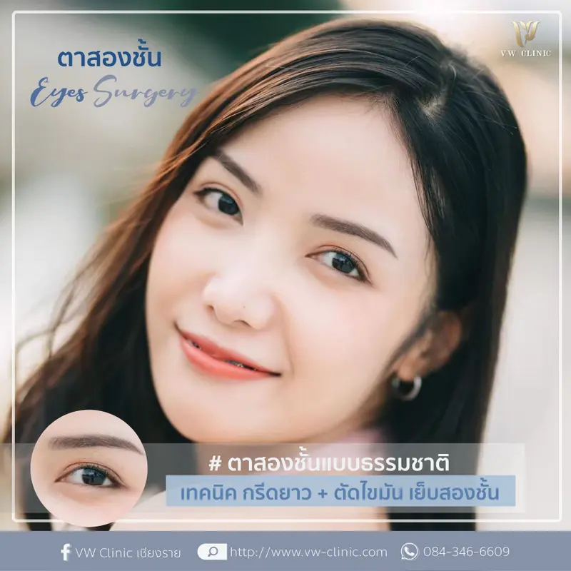 ตาสองชั้น