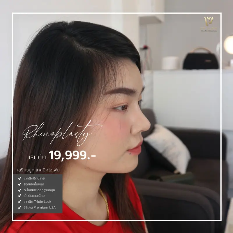 เสริมจมูก