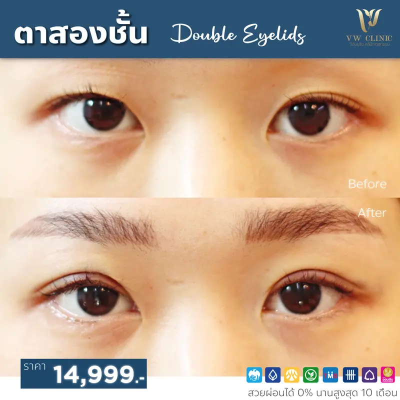 ตาสองชั้น