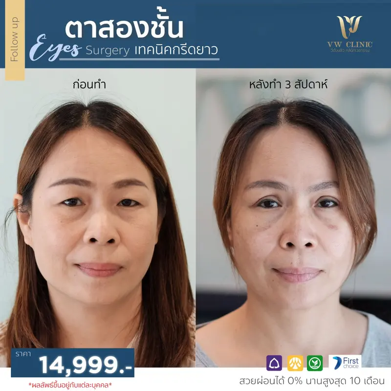 ตาสองชั้น