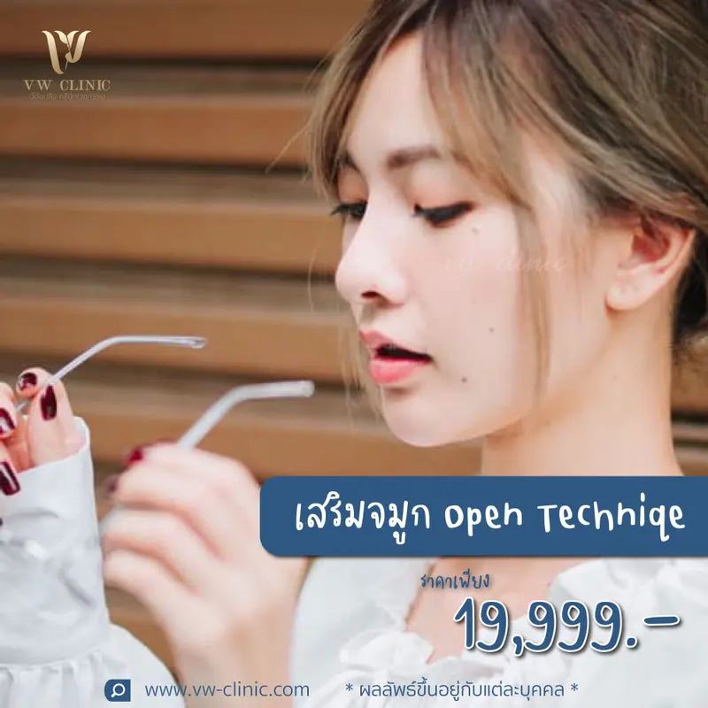 เสริมจมูก