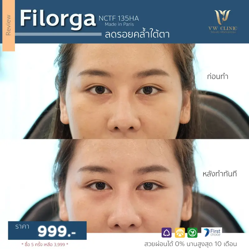 Filorga