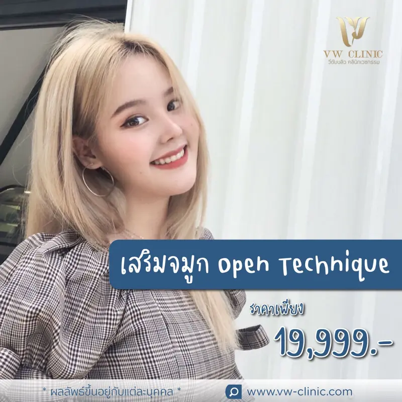 เสริมจมูก