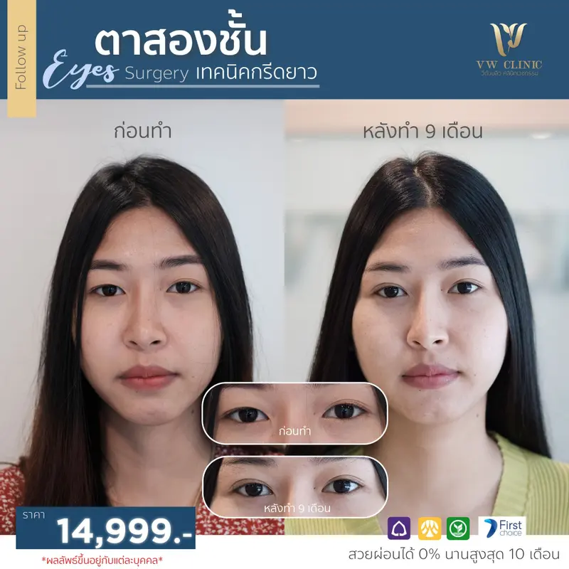 ตาสองชั้น