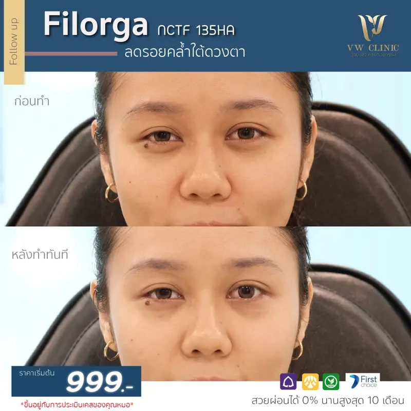 Filorga