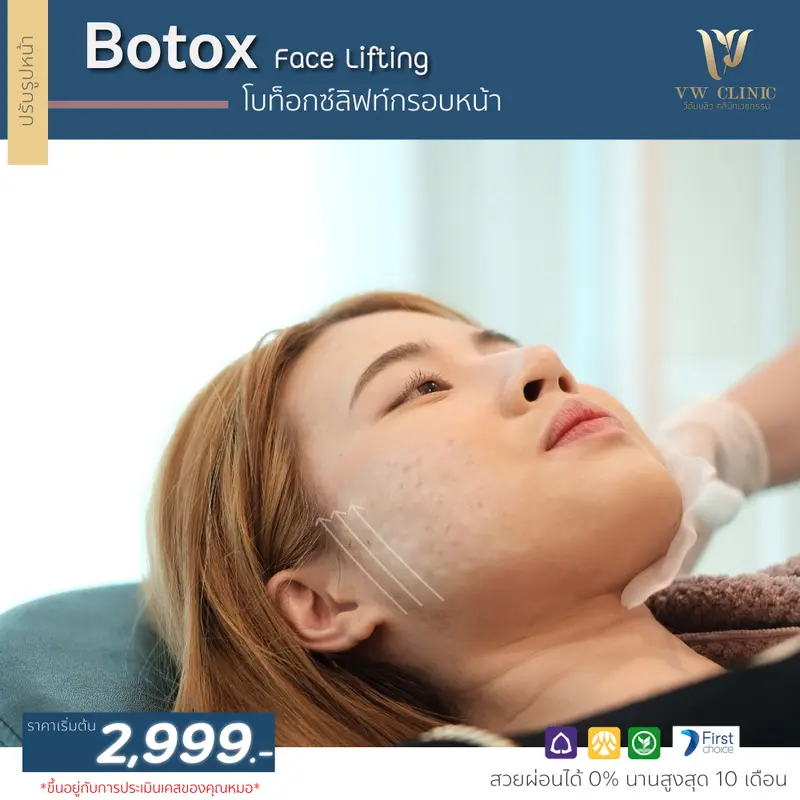 Botox lift กรอบหน้า
