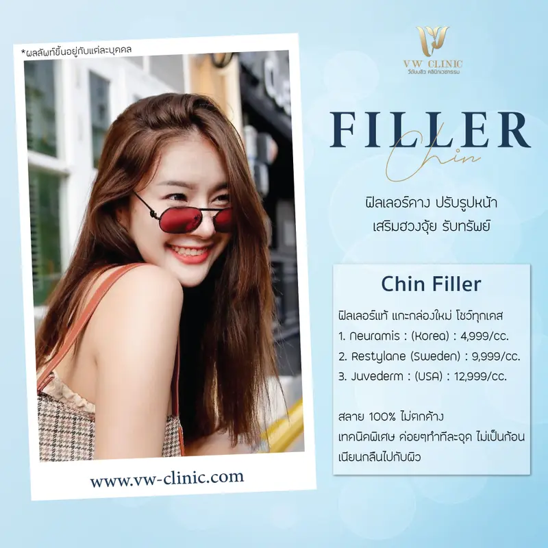 Filler คาง