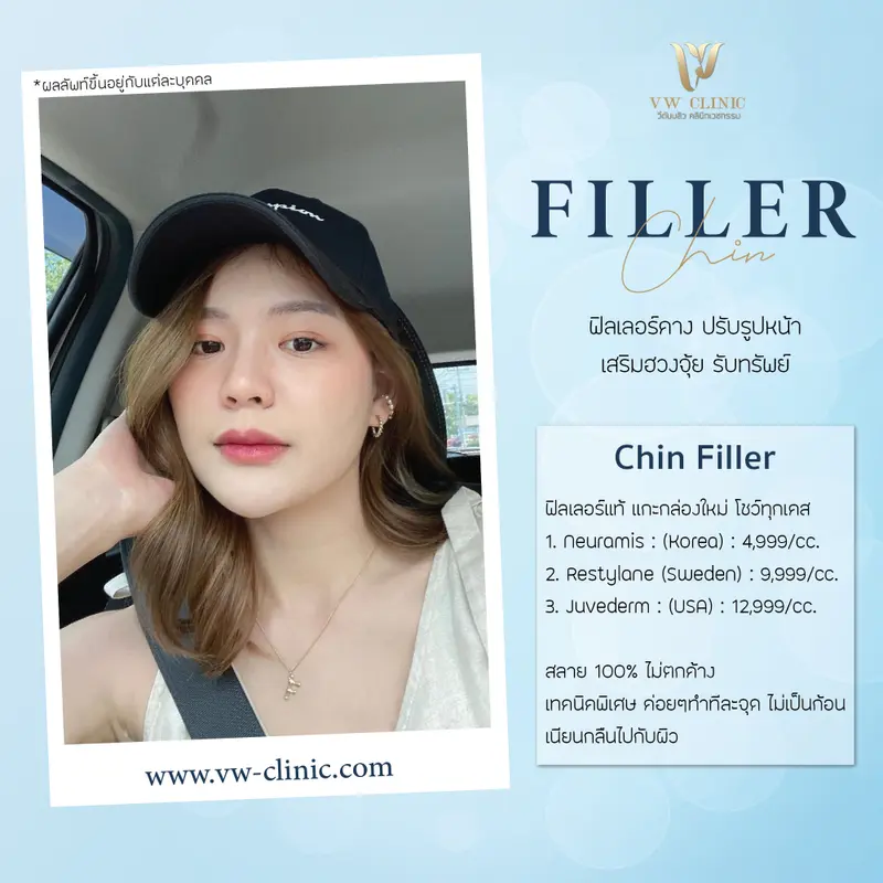 Filler คาง