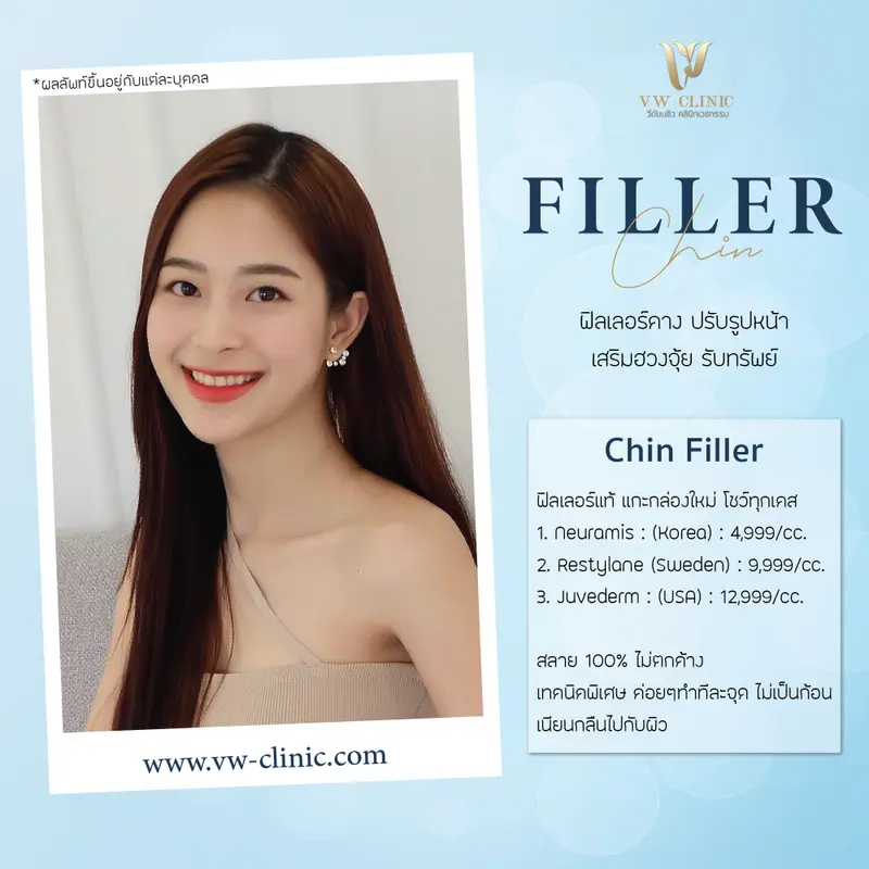 Filler คาง