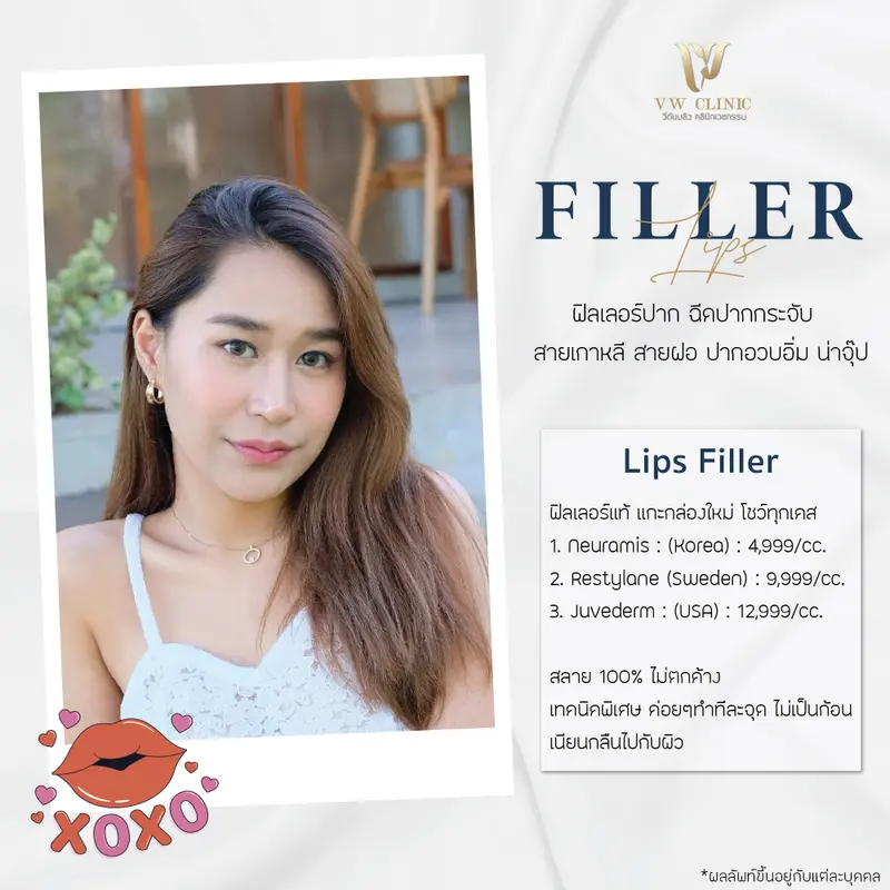 Filler ปาก