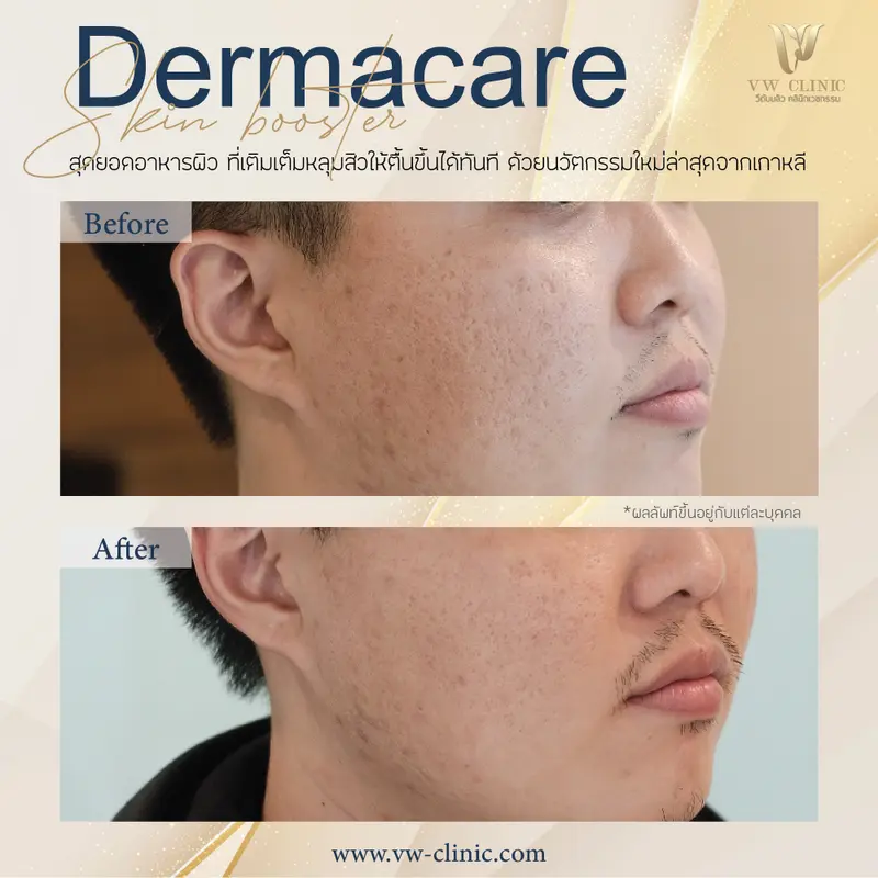 Dermacare