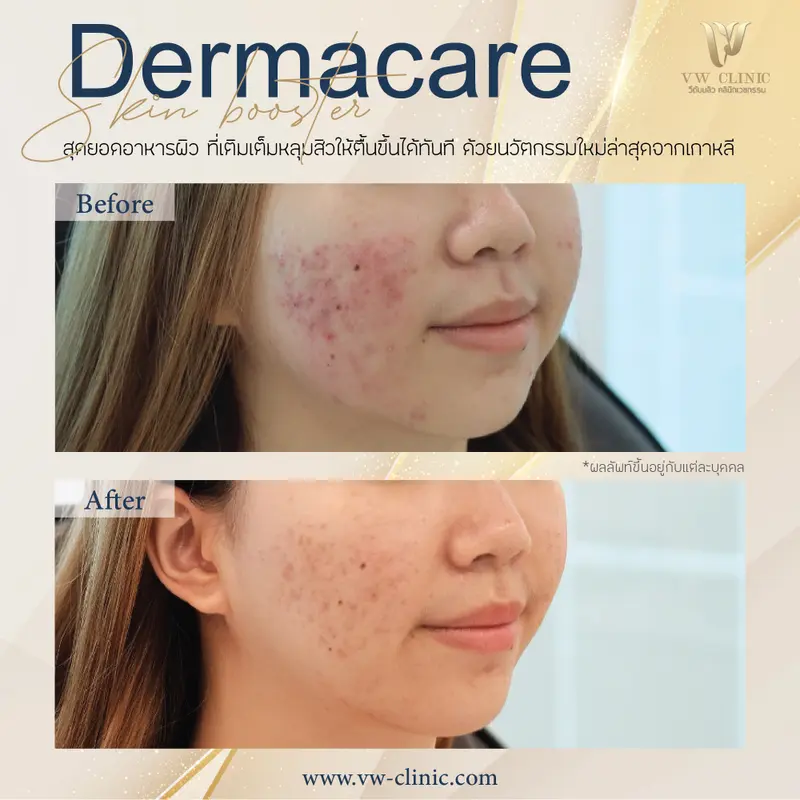 Dermacare