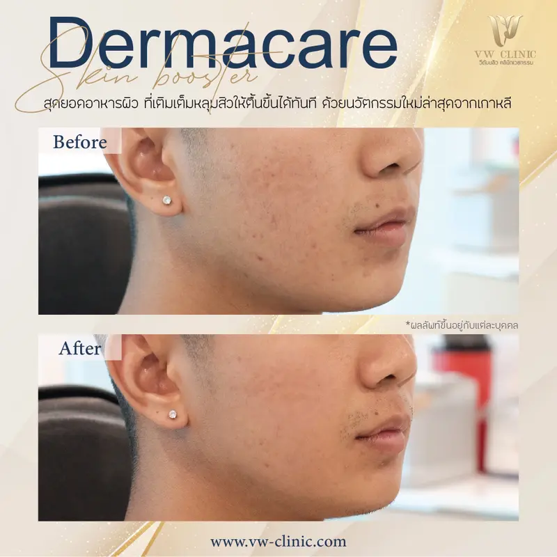 Dermacare