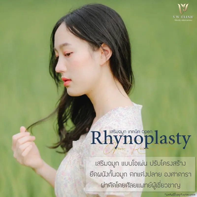 เสริมจมูก