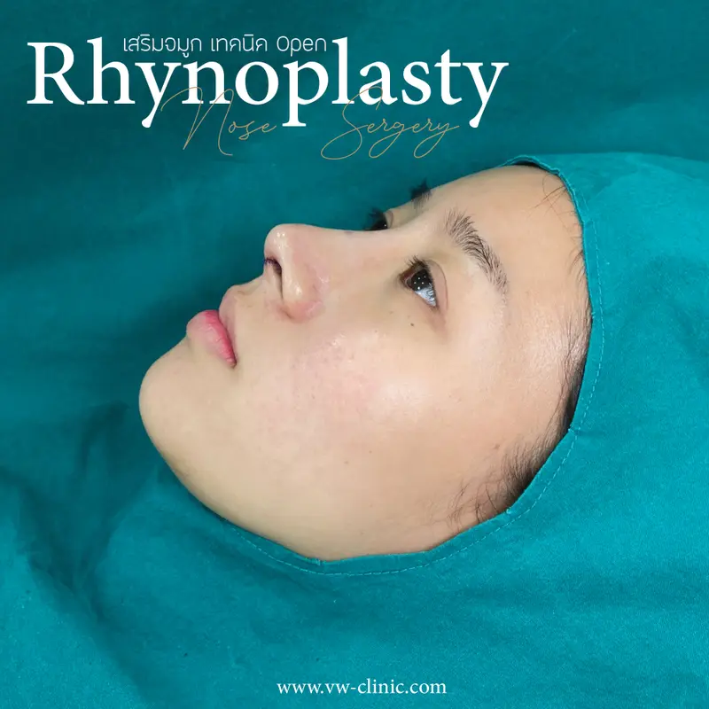 เสริมจมูก