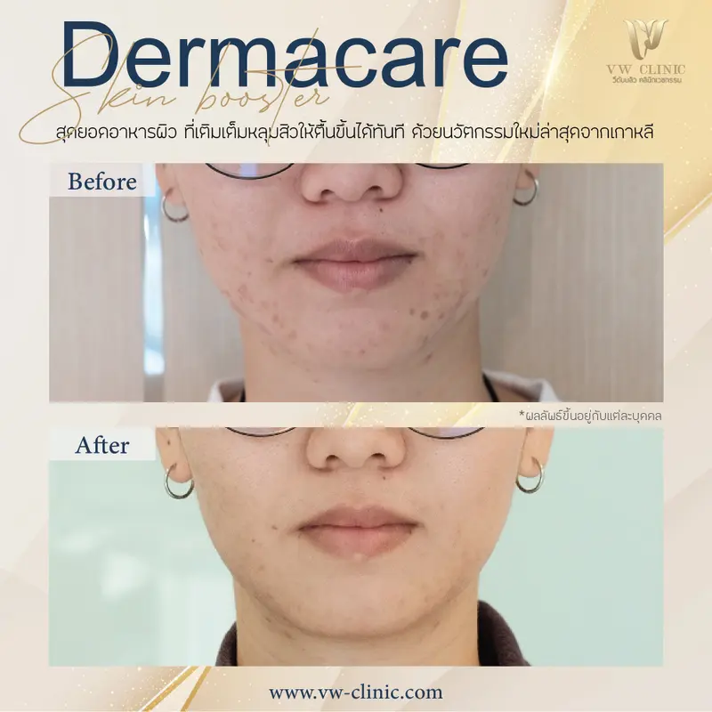 Dermacare