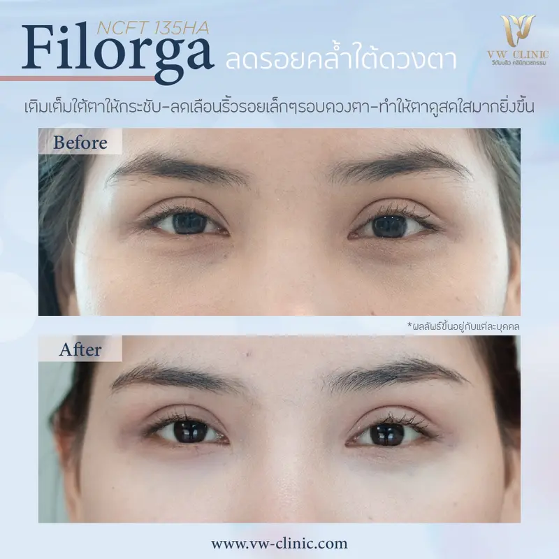 Filorga